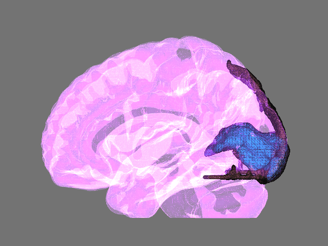 MRI Reconstruction of anterior cerebral artery